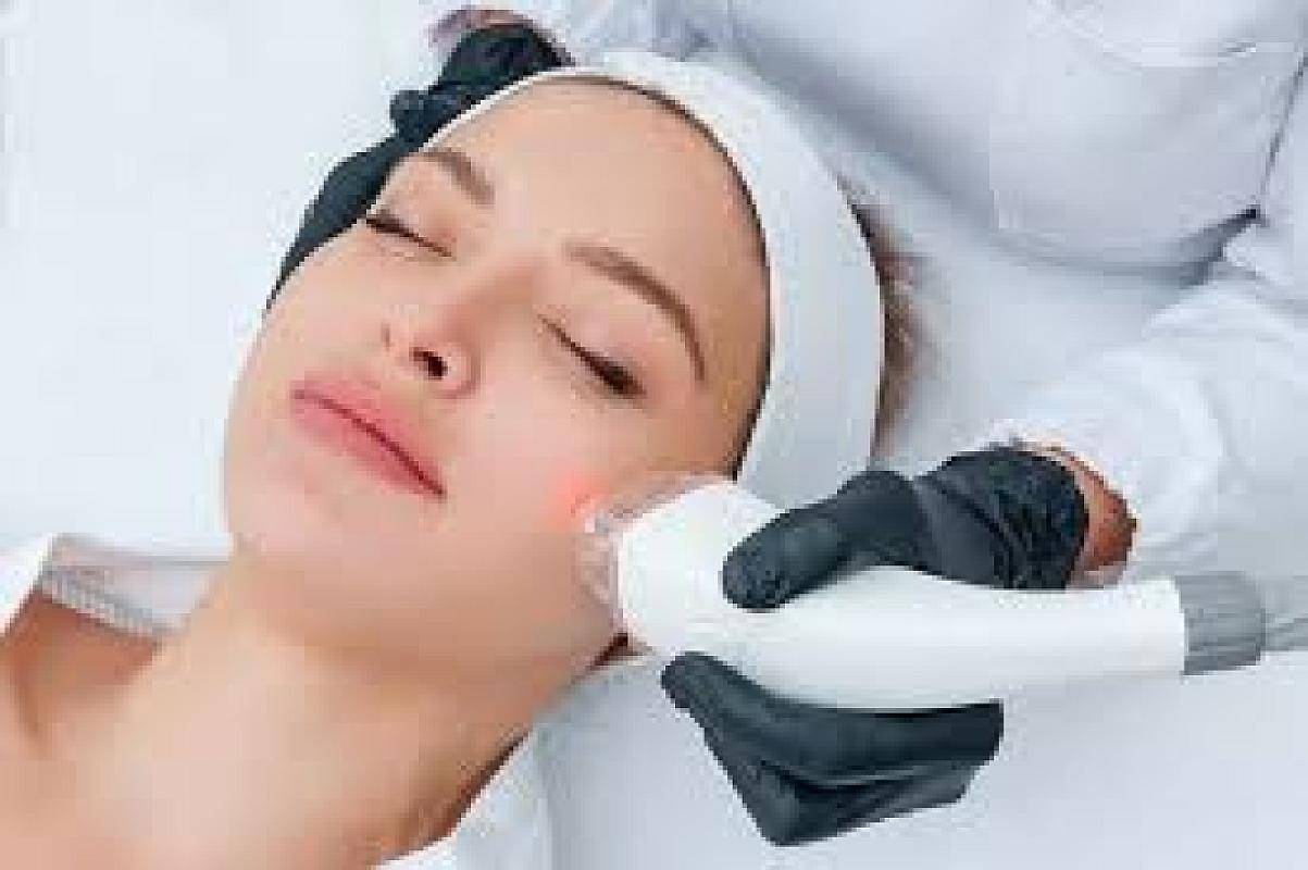 إزالة الشعر